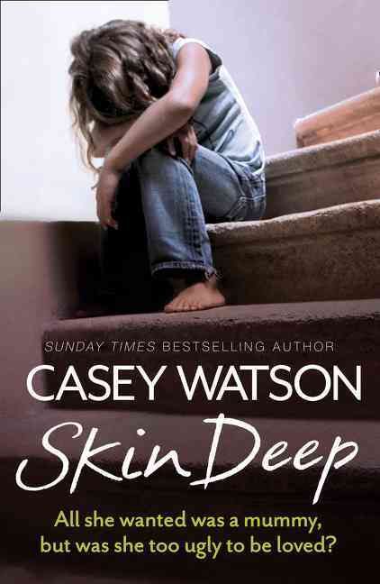 Skin Deep By Casey Watson 9780007595099 (Paperback)