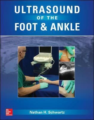 Ultrasound of the Foot and Ankle By Nathan H. Schwartz (editor)