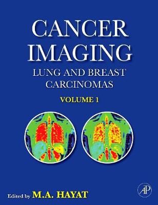Cancer Imaging By M. A. Hayat 9780123704689 (Hardback)