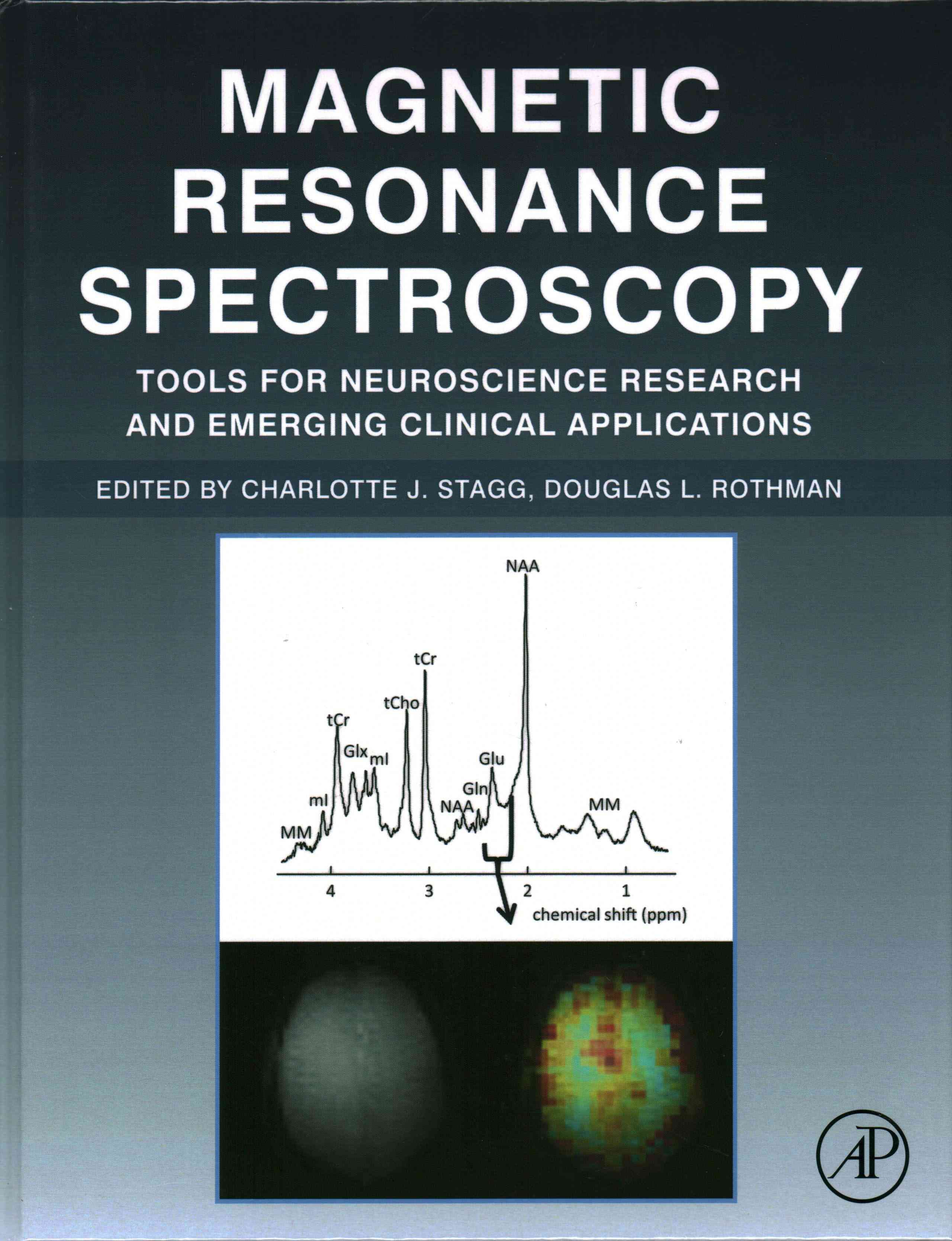 Magnetic Resonance Spectroscopy 9780124016880 (Hardback)