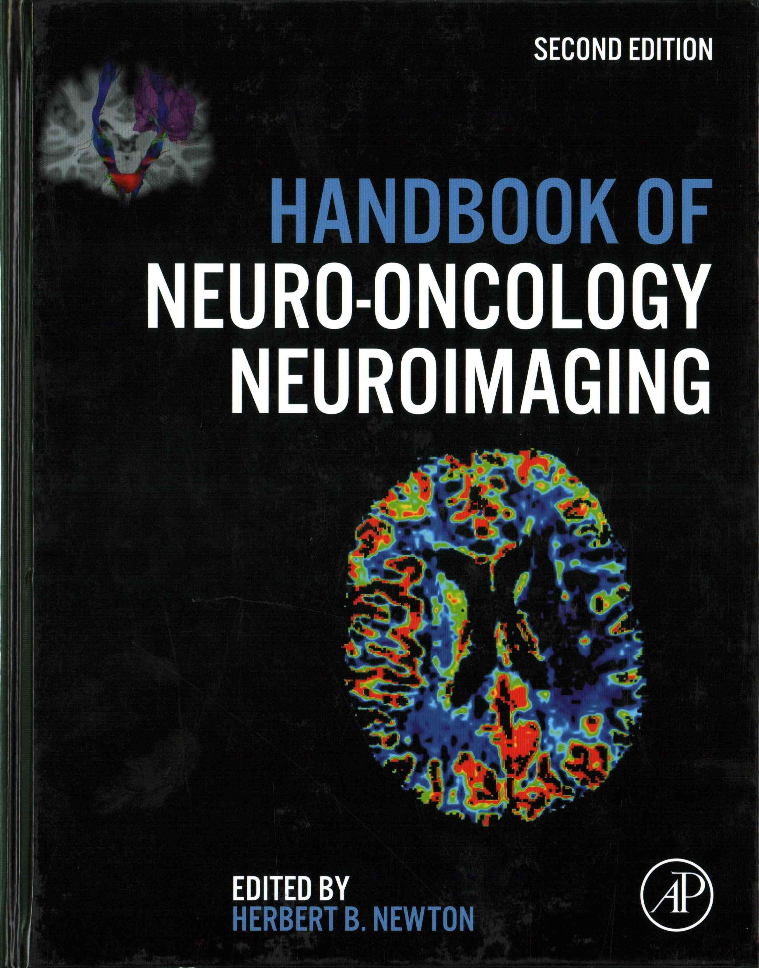Handbook of Neuro-Oncology Neuroimaging By Newton, Herbert B.