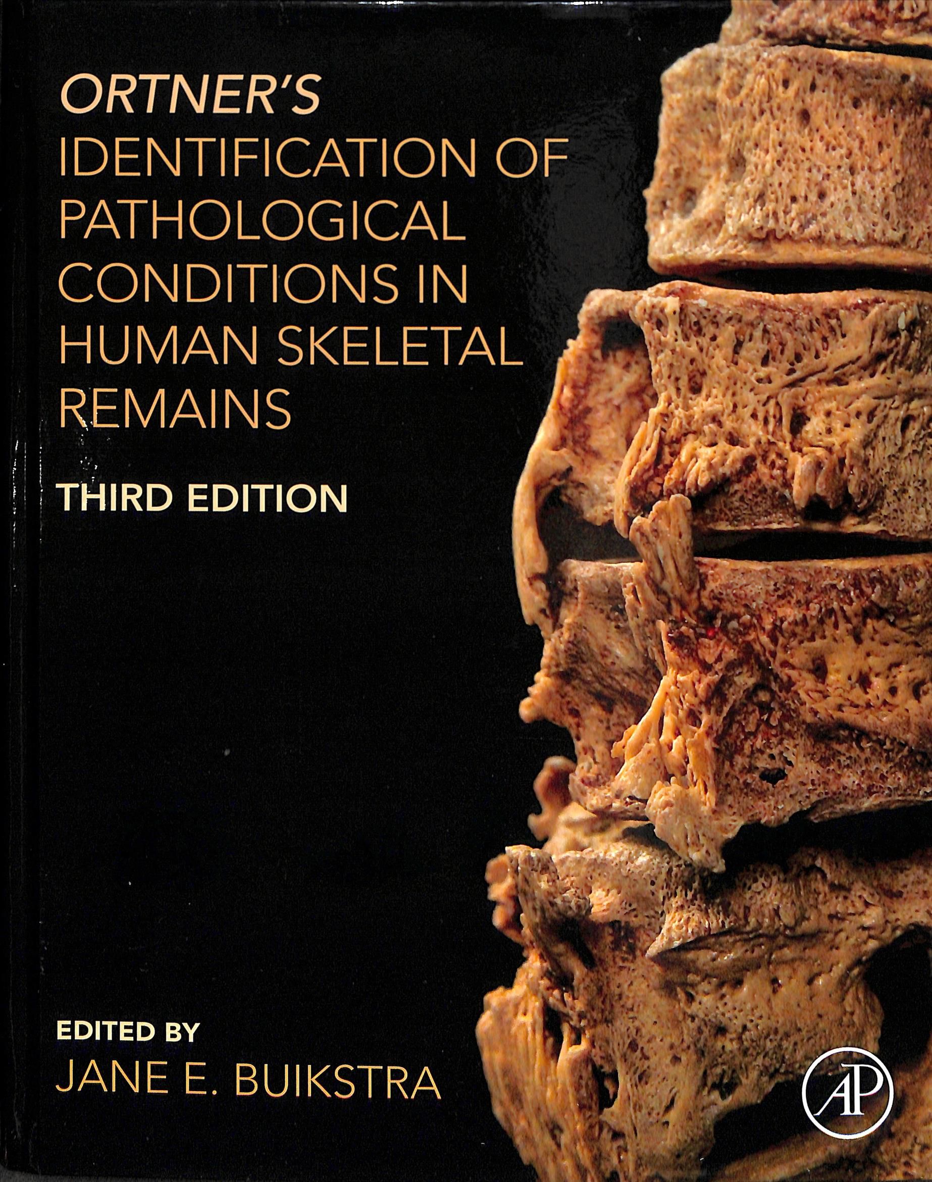 Ortner's Identification of Pathological Conditions in Human Skeletal Remains