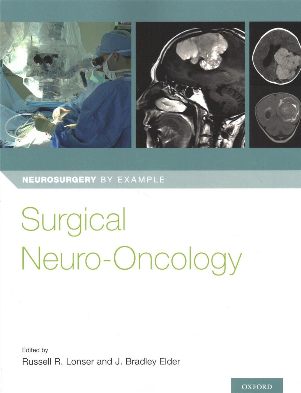 Surgical Neuro-Oncology 9780190696696 (Paperback)