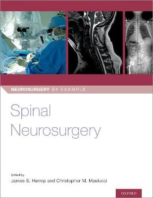 Spinal Neurosurgery 9780190887773 (Paperback)