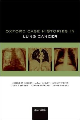 Oxford Case Histories in Lung Cancer 9780198813033 (Paperback)