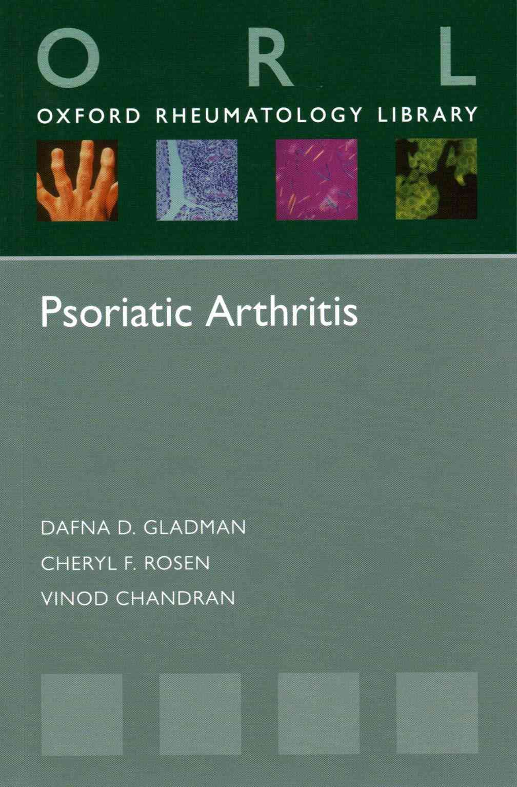 Psoriatic Arthritis 9780199692095 (Paperback)