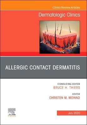 Allergic Contact Dermatitis By Christen M. Mowad (editor) (Hardback)