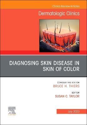 Diagnosing Skin Disease in Skin of Color By Susan C. Taylor (editor)