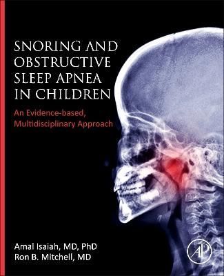 Snoring and Obstructive Sleep Apnea in Children 9780323996532