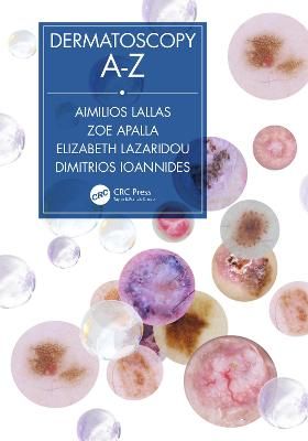 Dermatoscopy A-Z 9780367197841 (Hardback)