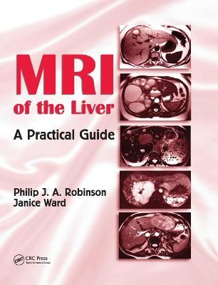 MRI of the Liver By P. J. Robinson, Janice Ward 9780367390754