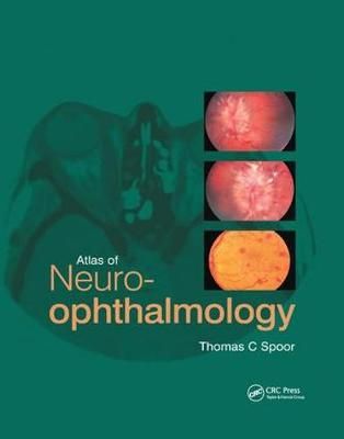 Atlas of Neuro-Ophthalmology By Thomas C. Spoor 9780367394349