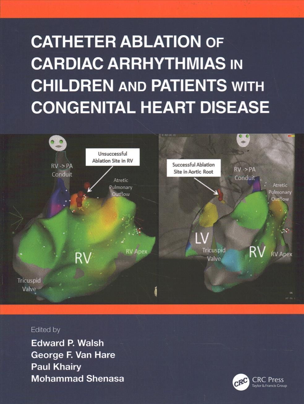 Catheter Ablation of Cardiac Arrhythmias in Children and Patients with Congenital Heart Disease