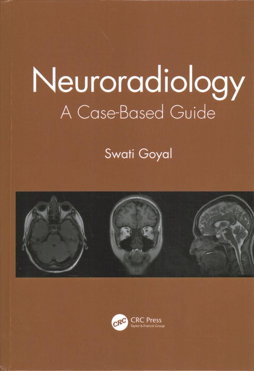Neuroradiology By Swati Goyal 9780367548001 (Hardback)