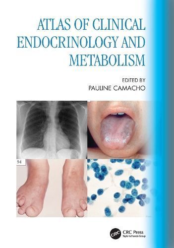 Atlas of Clinical Endocrinology and Metabolism 9780367608330