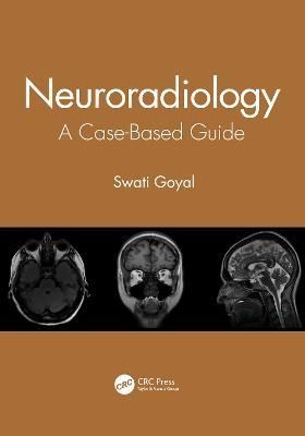 Neuroradiology By Swati Goyal 9780367903190 (Paperback)