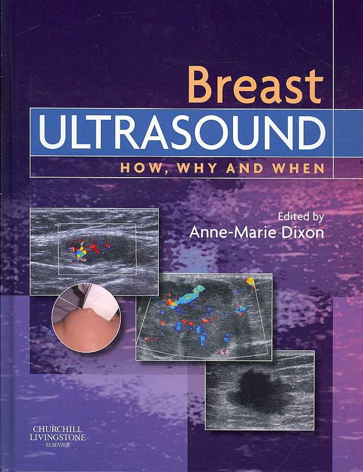 Breast Ultrasound By Anne-Marie Dixon 9780443100765 (Hardback)