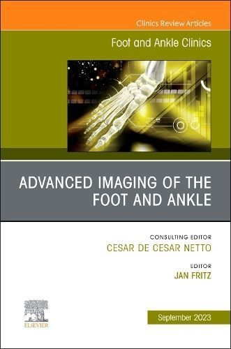 Advanced Imaging of the Foot and Ankle By Jan Fritz (editor)