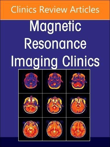 MR-Guided Focused Ultrasound 9780443246661 (Hardback)