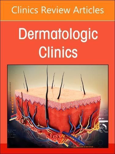 The Evolving Landscape of Atopic Dermatitis 9780443293665 (Hardback)