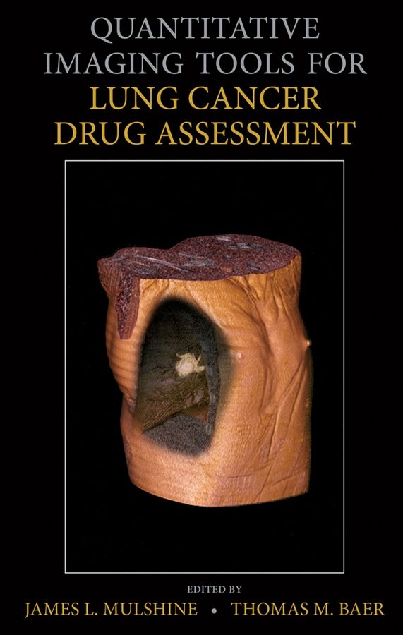 Quantitative Imaging Tools for Lung Cancer Drug Assessment (Hardback)
