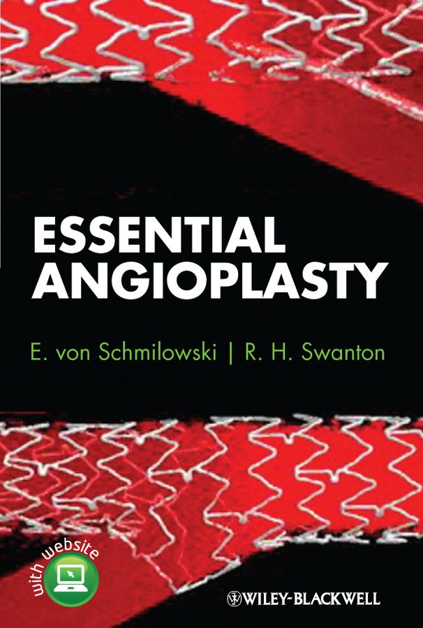 Essential Angioplasty By E von Schmilowski 9780470657263 (Hardback)