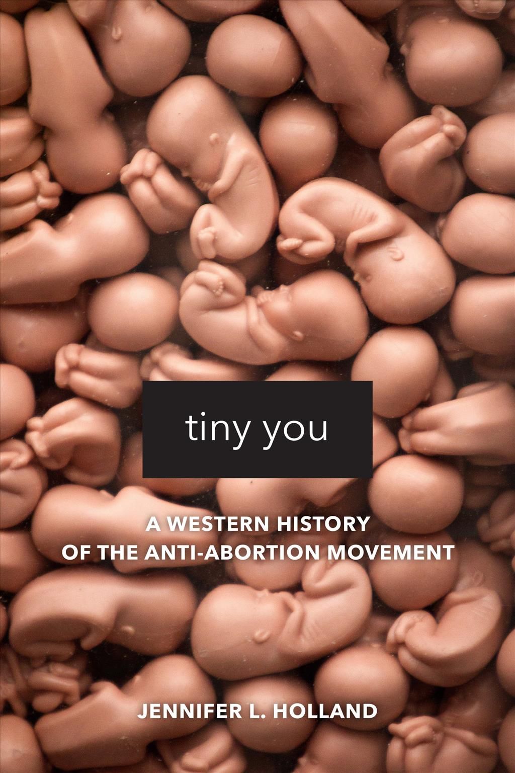Tiny You By Jennifer L. Holland 9780520295872 (Paperback)