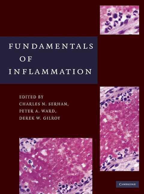 Fundamentals of Inflammation 9780521887298 (Hardback)