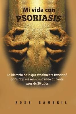 Mi Vida Con PSORIASIS 9780578335490 (Paperback)