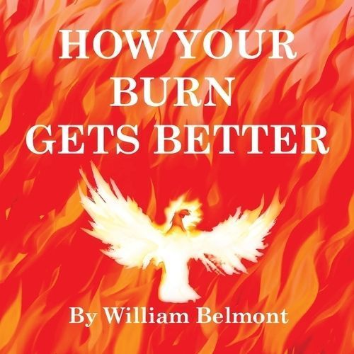 How Your Burn Gets Better By William Belmont (creator) 9780645932966