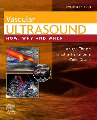 Vascular Ultrasound 9780702046568 (Hardback)