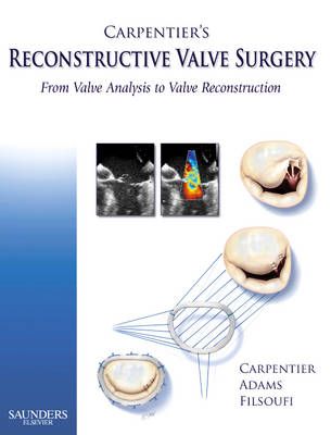 Carpentier's Reconstructive Valve Surgery 9780721691688 (Hardback)