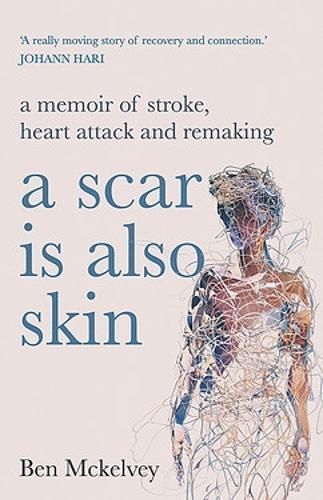 A Scar Is Also Skin By Ben Mckelvey 9780733645044 (Paperback)