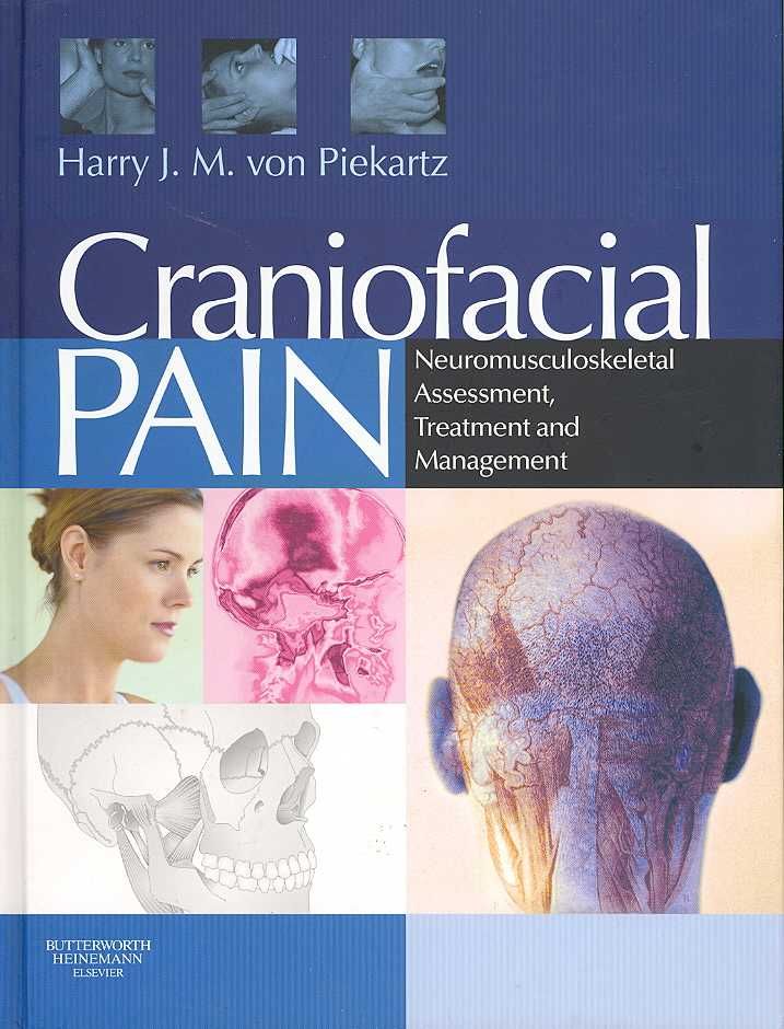 Craniofacial Pain 9780750687744 (Paperback)