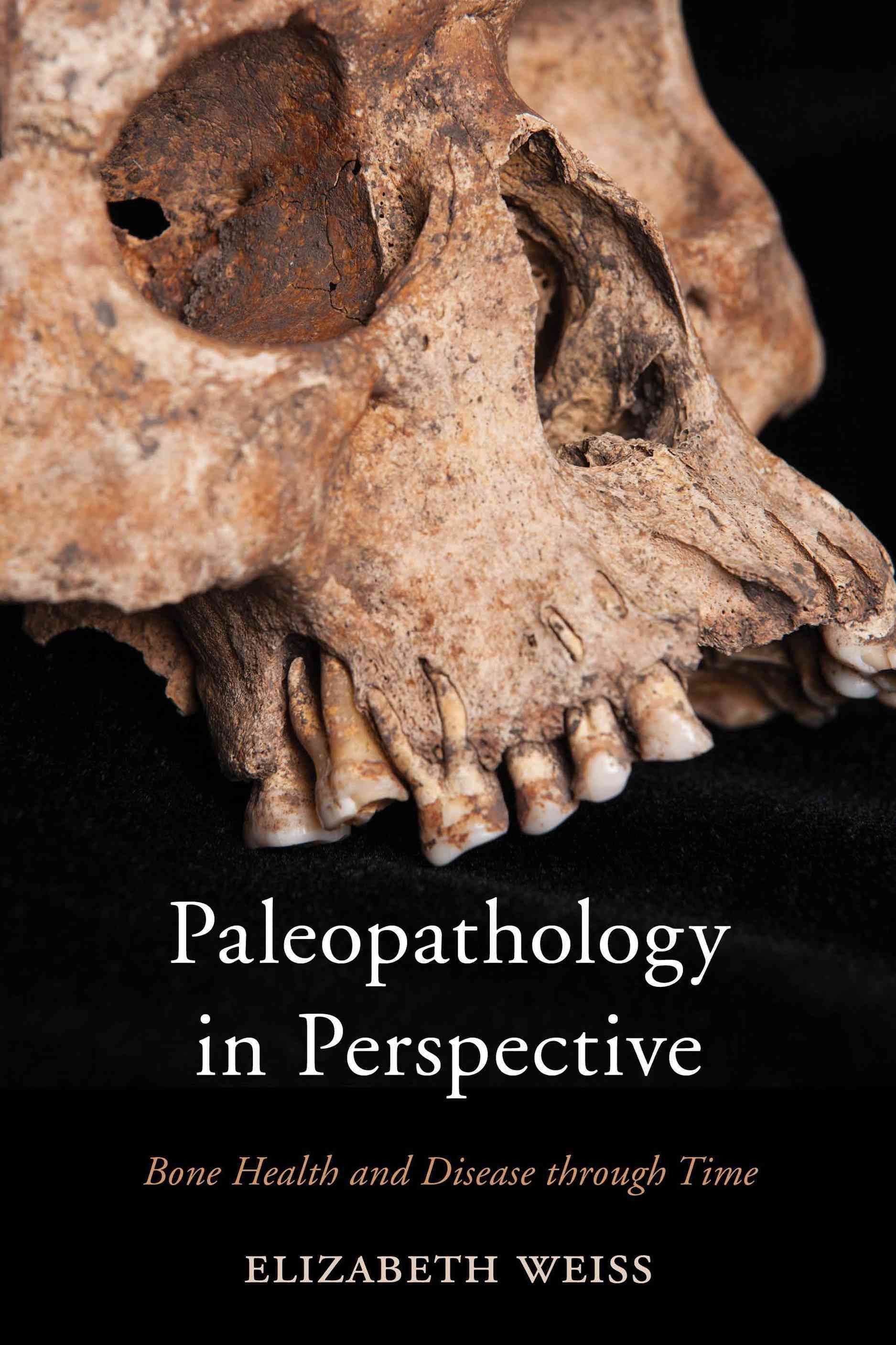 Paleopathology in Perspective By Elizabeth Weiss 9780759124424