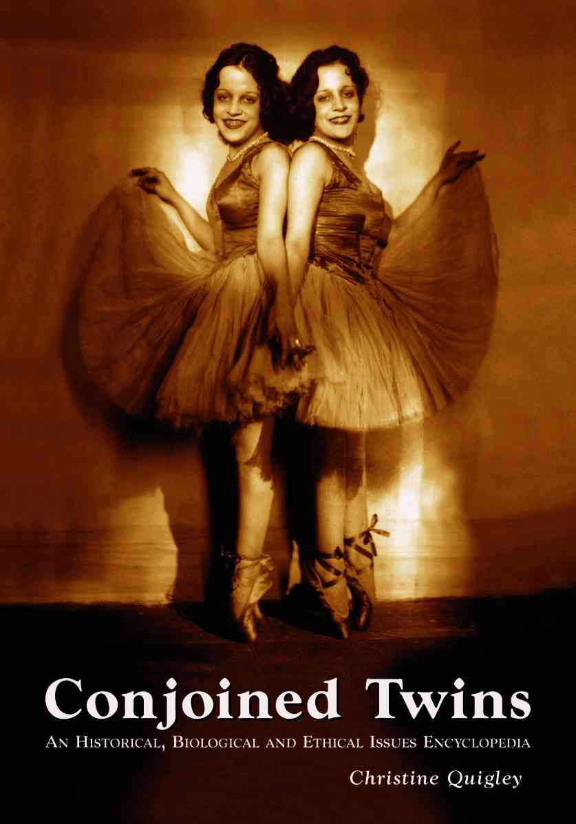 Conjoined Twins By Christine Quigley 9780786428526 (Paperback)