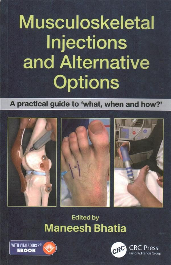 Musculoskeletal Injections and Alternative Options 9780815355540