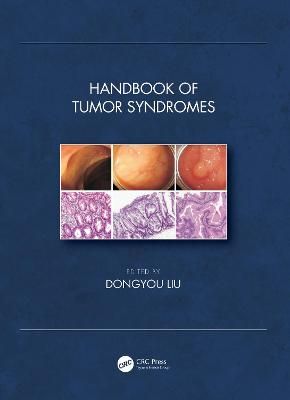 Handbook of Tumor Syndromes By Dongyou Liu (editor) 9780815393801