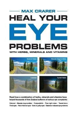 Heal Your Eye Problems With Herbs, Minerals and Vitamins 9780908850211