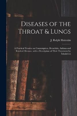 Diseases of the Throat & Lungs [microform] By Malcolm 9781014795625