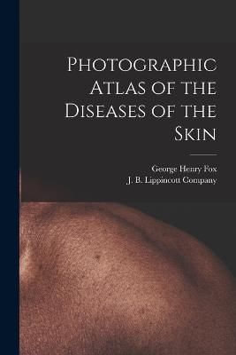 Photographic Atlas of the Diseases of the Skin By Fox 9781018089126