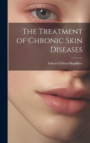 Treatment of Chronic Skin Diseases By Mapother 9781019422519