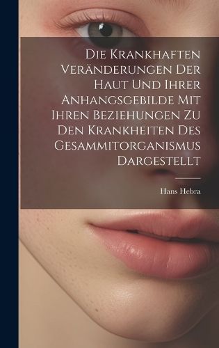 Krankhaften Veränderungen Der Haut Und Ihrer Anhangsgebilde Mit Ihren Beziehungen Zu Den Krankheiten Des Gesammitorganismus Dargestellt