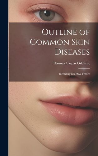 Outline of Common Skin Diseases By Gilchrist 9781020324918 (Hardback)
