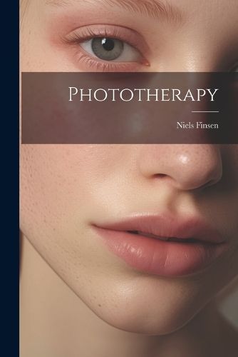 Phototherapy By Finsen 9781021175847 (Paperback)