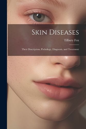 Skin Diseases By Fox 9781021652935 (Paperback)