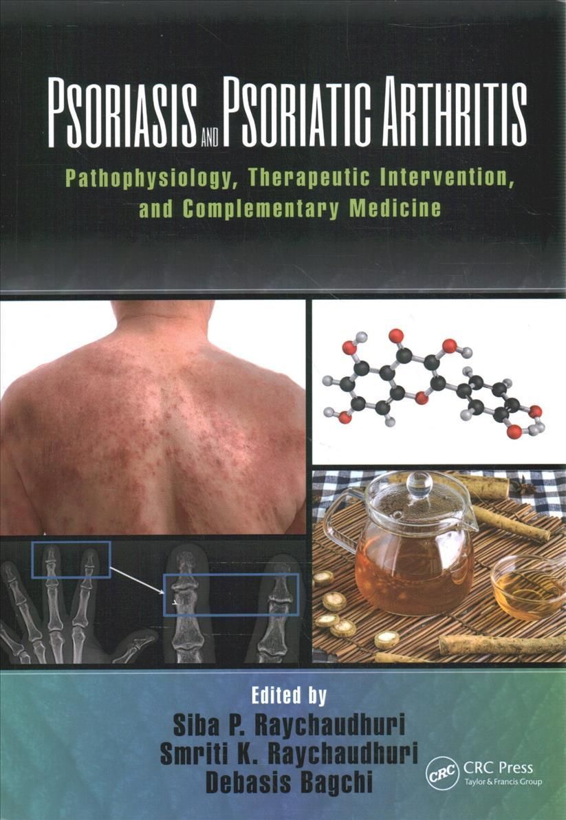 Psoriasis and Psoriatic Arthritis 9781032095868 (Paperback)