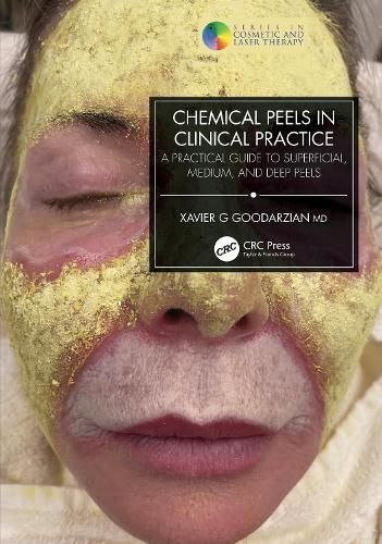 Chemical Peels in Clinical Practice By Xavier G Goodarzian (Paperback)