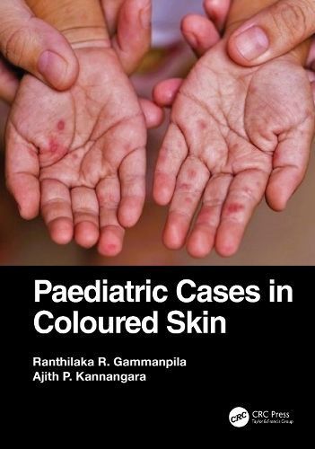 Paediatric Cases in Coloured Skin 9781032343150 (Paperback)