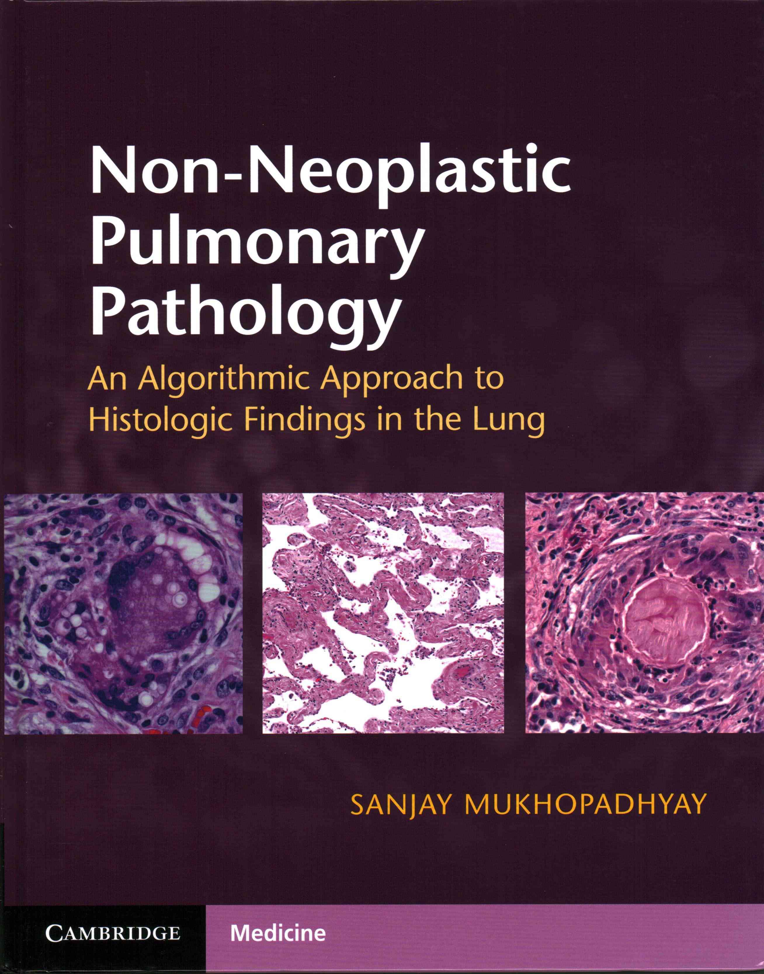 Non-Neoplastic Pulmonary Pathology By Sanjay Mukhopadhyay (Paperback)